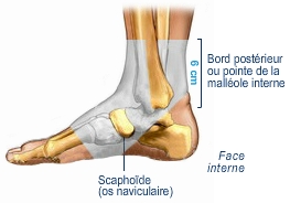 Quand faire une radiographie pour une entorse de cheville? | BlogDuKine
